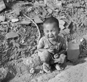 Survivor of the Hiroshima Atomic Bombing